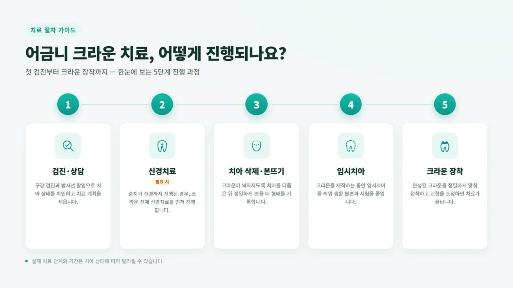 신경치료 후 크라운 비용 본문 이미지